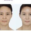 HOP+ Sculplla Promoter Repair Eye Cream - Image 6